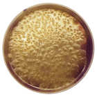 CLOSTRIDIUM PERFRINGES AGAR BASE (m-CP) 500 grams/bottle