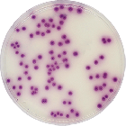 SALMONELLA CHROMOGENIC AGAR 500 grams/bottle